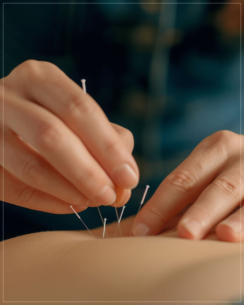 Acupuntura no Tatuapé, SP | As melhores clínicas de acupuntura do Tatuapé, São Paulo